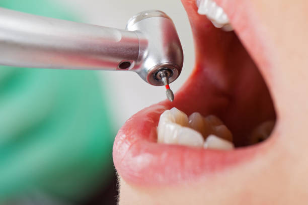 Best Emergency Broken Tooth Repair in Winton, CA